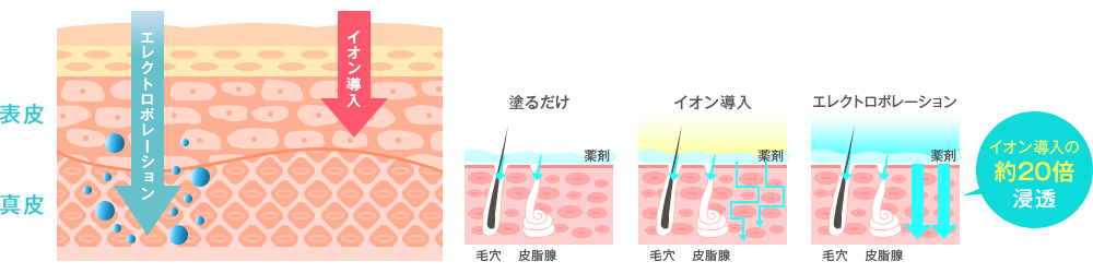 ポレーションとは・・・